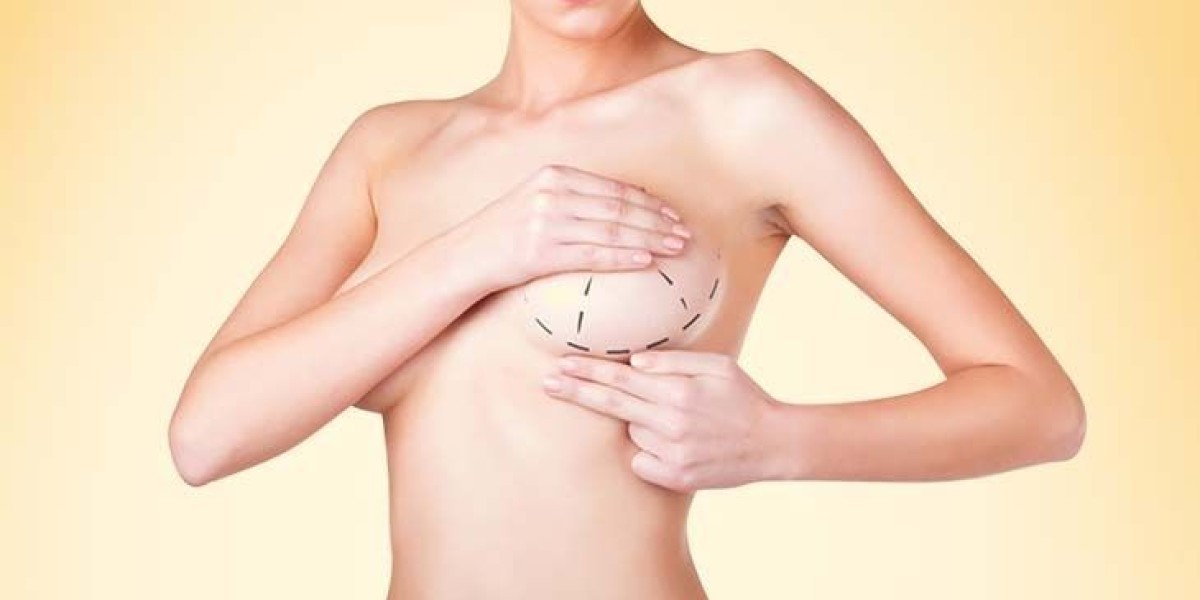 How Breast Augmentation in Dubai Can Improve Breast Symmetry
